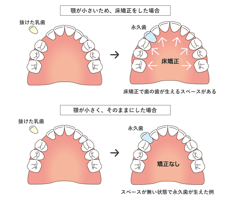 矯正臨床の基礎 矯正臨床の基礎 - クインテッセンス出版